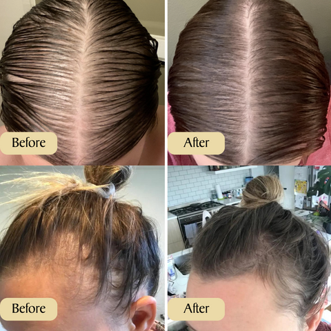 Vegan Hair Growth Oil - Low in Stock